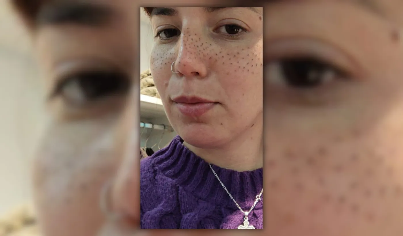 La dura carta de la joven de La Plata que pidió que le resalten las pecas y terminaron arruinándole la cara